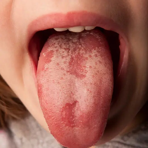 Why Everyone Should be Tongue Scraping by Goddess Provisions